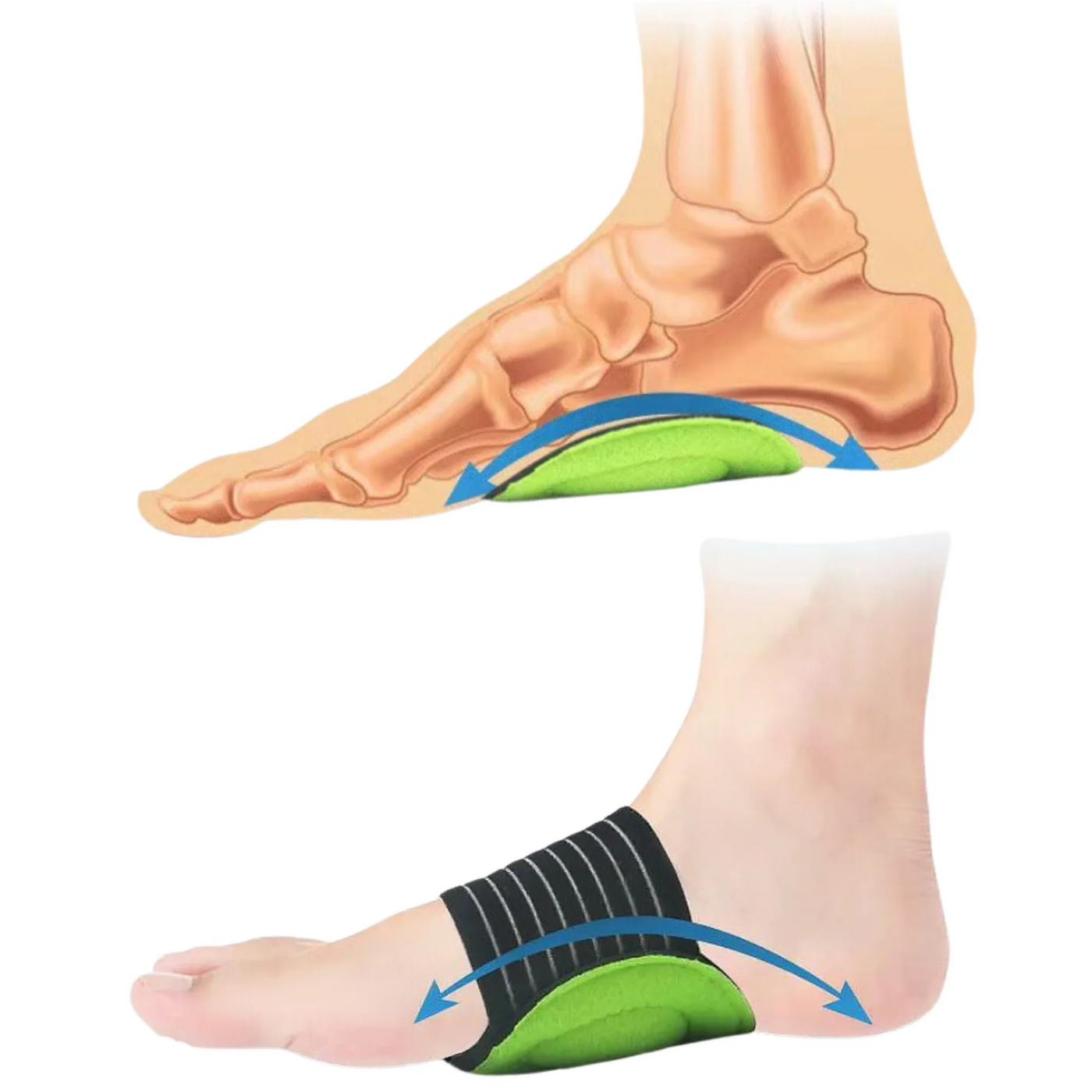 Springer Arch Support Brace™